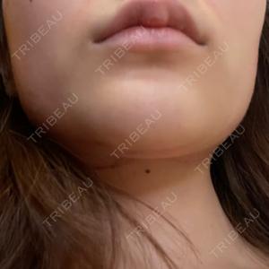 BITO BEAUTY CLINIC BITO BEAUTY CLINIC口コミ