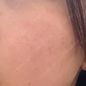 TCB東京中央美容外科 TCB東京中央美容外科 藤沢院口コミ