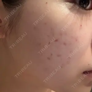 L‘amour clinic Tokyo【ラムールクリニック東京】口コミ