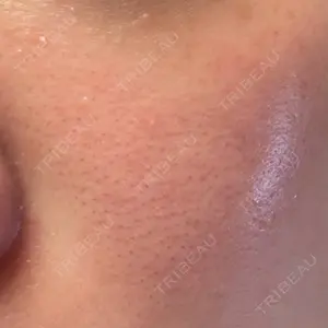 Natural Skin Clinic Natural Skin Clinic 笹塚院口コミ