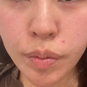 口コミ