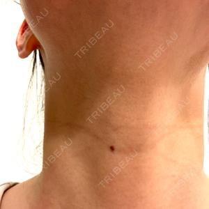 エルムクリニック 美容皮膚科エルムクリニック 福岡院口コミ