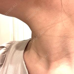 エルムクリニック 美容皮膚科エルムクリニック 福岡院口コミ