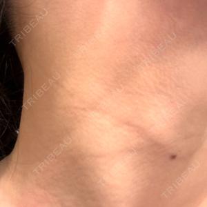エルムクリニック 美容皮膚科エルムクリニック 福岡院口コミ