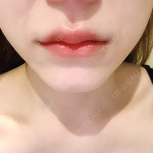 口コミ