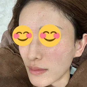 PureMe Skin Clinic（ピュアミースキンクリニック麻布）口コミ