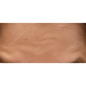 TCB東京中央美容外科 TCB東京中央美容外科 大宮東口院口コミ