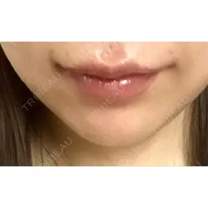 口コミ