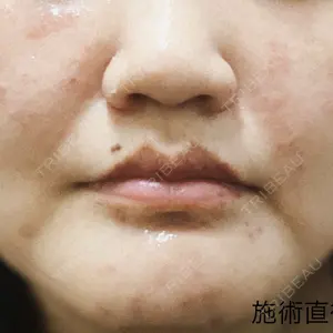 東京シルククリニック 東京シルククリニック 東京神田院口コミ