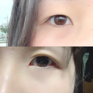 湘南美容クリニック 湘南美容クリニック 宇都宮院口コミ