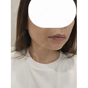 フィラークリニック フィラークリニック 名古屋栄院口コミ