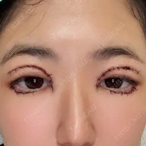 口コミ