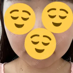 東京シンデレラ美容外科 東京シンデレラ美容外科 大宮院口コミ