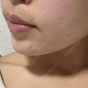 TCB東京中央美容外科 TCB東京中央美容外科 岡山院口コミ