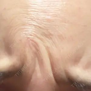 東京シルククリニック 東京シルククリニック 東京神田院口コミ