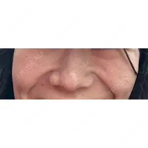 東京シルククリニック 東京シルククリニック 東京神田院口コミ