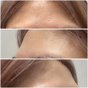 plume clinic plume clinic口コミ