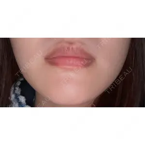 L‘amour clinic Tokyo【ラムールクリニック東京】の