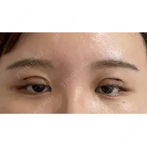 大塚美容形成外科 大塚美容形成外科 銀座本院口コミ