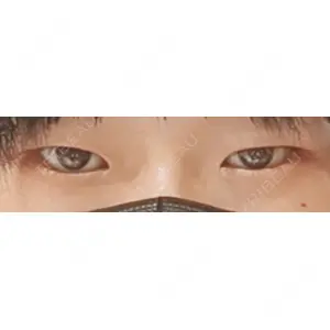 LOCHIC CLINIC GINZA【ロシッククリニック銀座】口コミ