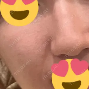 ミニマムスキンクリニック ミニマムスキンクリニック池袋口コミ