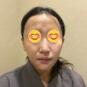 AVAN TOKYO 銀座脂肪吸引 クリニックの