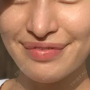 口コミ