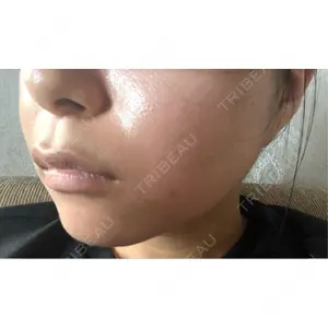 東京シルククリニック 東京シルククリニック 東京神田院口コミ