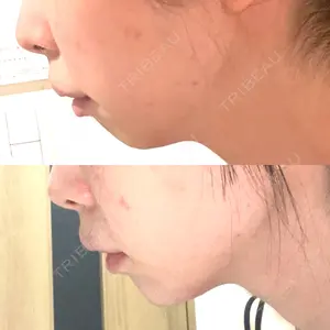 ルラ美容クリニック ルラ美容クリニック 大宮院 / ルラスキンクリニック 大宮院口コミ