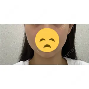 湘南美容クリニック 湘南美容クリニック 秋葉原院口コミ