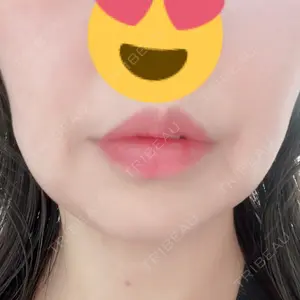 湘南美容クリニック 江坂院の