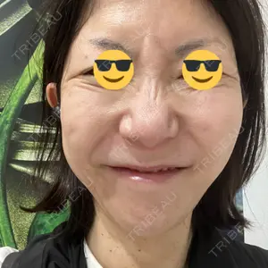 TCB東京中央美容外科 TCB東京中央美容外科 大宮東口院口コミ