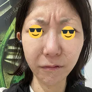 TCB東京中央美容外科 TCB東京中央美容外科 大宮東口院口コミ