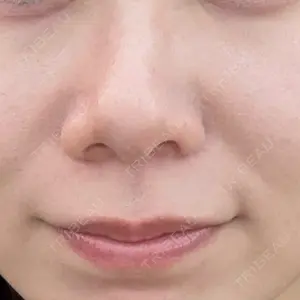 東京シルククリニック 東京シルククリニック 東京神田院口コミ