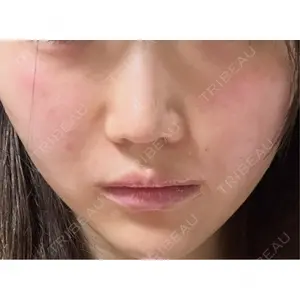 CZEN CLINIC 銀座院口コミ