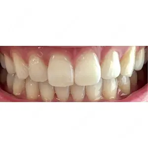 アンデルト歯科・矯正歯科口コミ