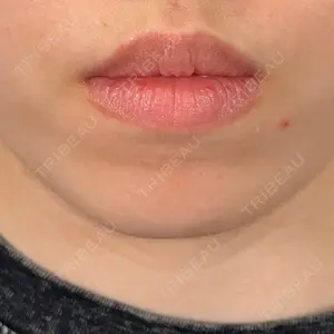 アリエル美容クリニック アリエル美容クリニック 横浜院口コミ