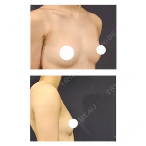 S.T styleクリニック口コミ