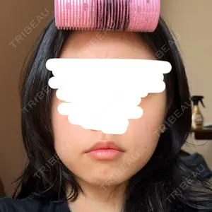 PureMe Skin Clinic（ピュアミースキンクリニック麻布）口コミ