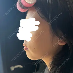 PureMe Skin Clinic（ピュアミースキンクリニック麻布）口コミ