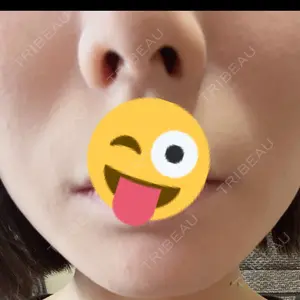 フィラークリニック フィラークリニック 新宿院口コミ