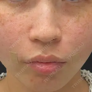 スマートスキンクリニック スマートスキンクリニック 神保町院口コミ