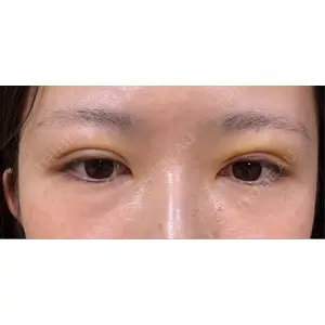 APOLLO BEAUTY CLINIC口コミ