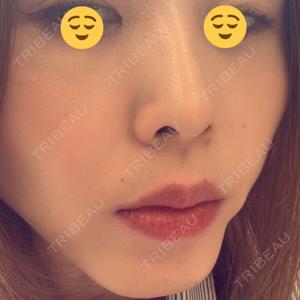 TCB東京中央美容外科 TCB東京中央美容外科 札幌駅前院口コミ