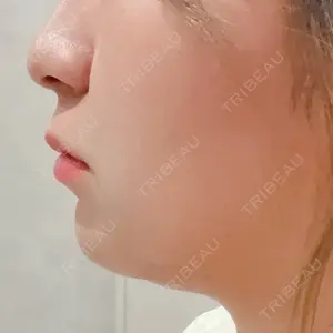Nebula Clinic 札幌美容外科ネビュラクリニック口コミ