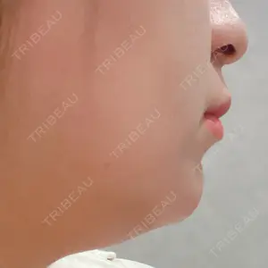 Nebula Clinic 札幌美容外科ネビュラクリニック口コミ