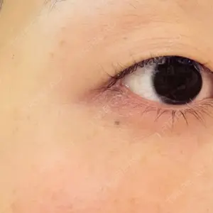 ヴァージンクリニック ヴァージンクリニック 広島院口コミ