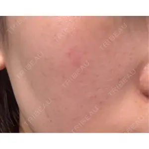 L‘amour clinic Tokyo【ラムールクリニック東京】口コミ