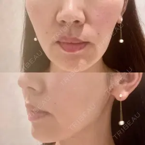 Nebula Clinic 札幌美容外科ネビュラクリニック口コミ