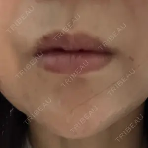 渋谷美容外科クリニック 渋谷美容外科クリニック 横浜院口コミ